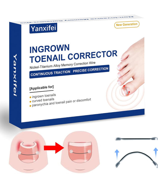 Nitinol Ingrown Toenail Corrector,at Home Ingrown Toenail Treatment,Curved Toenail Straightener,Ingrown Toe Nail Relief，Ingrown Toenail Removal Kit (1