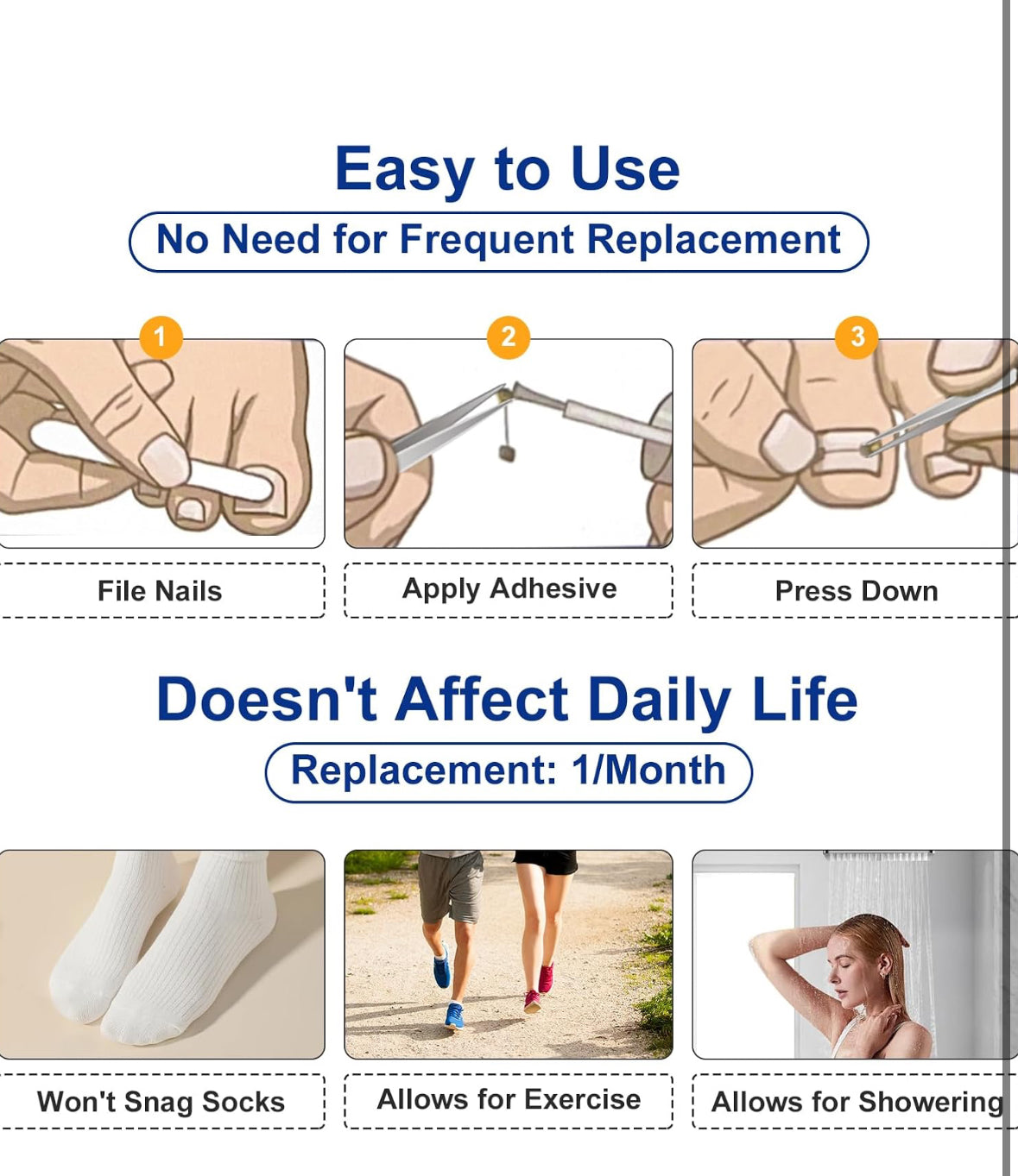 Nitinol Ingrown Toenail Corrector,at Home Ingrown Toenail Treatment,Curved Toenail Straightener,Ingrown Toe Nail Relief，Ingrown Toenail Removal Kit (1